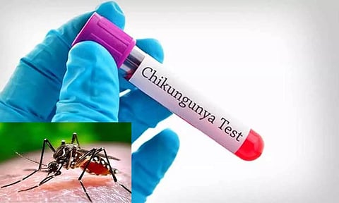 தமிழ்நாட்டில் மீண்டும் பரவும் 'சிக்குன் குனியா' காய்ச்சல்