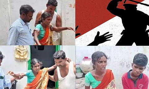 திருட்டு வழக்கில் தலித் பெண்ணுக்கு போலீஸ் ஸ்டேஷனில் சித்ரவதை.. காலை உடைத்த கொடூரம்