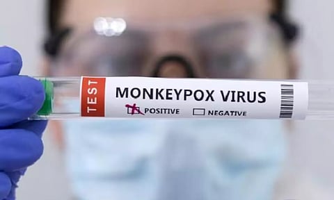monkeypox virus