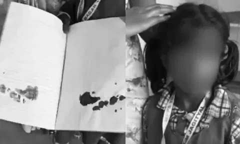 வீட்டுப்பாடம் செய்யாத சிறுமியை அறைந்த ஆசிரியர்.. காதில் ரத்தம் கொட்டியதால் பரபரப்பு - வீடியோ