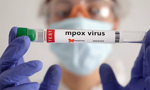 சிங்கப்பூரில் குரங்கு அம்மையால் 13 பேர் பாதிப்பு