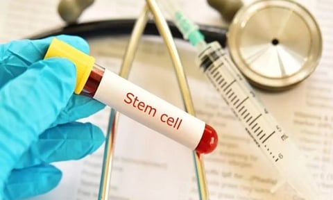 ஸ்டெம் செல் சிகிச்சையால் பெண்கள் அடையும் நன்மைகள்!