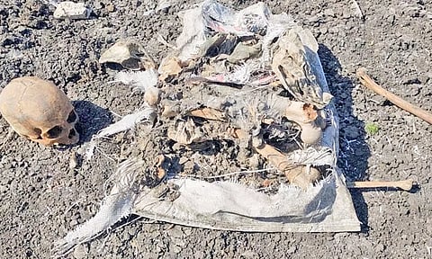 ஏரியில் சாக்குமூட்டையில் கிடந்த மனித எலும்புக்கூடு கொலையா?