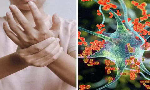 மகாராஷ்டிராவில் 'ஜிபிஎஸ்' நோயால் பாதிக்கப்பட்ட ஒருவர் மரணம்- புனேயில் பாதிப்பு 101 ஆக உயர்வு