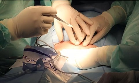 பெண்ணின் வயிற்றுக்குள் வைத்து தைக்கப்பட்ட 'Surgical Mop..' மகப்பேறு அறுவை சிகிச்சையில் விபரீதம்