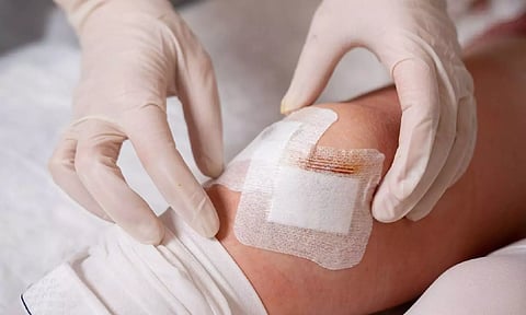 காயங்களை கட்டி மூடி வைப்பது சரியா? அப்படியே திறந்துவிடுவது நல்லதா?