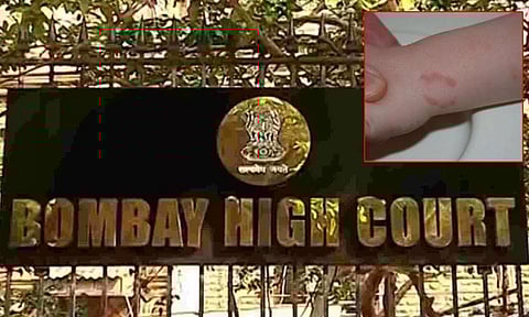 மனித பற்களை பயங்கர ஆயுதமாக கருத முடியாது: நாத்தனார் கடித்ததாக தொடர்ந்த வழக்கில் உயர்நீதிமன்றம் கருத்து