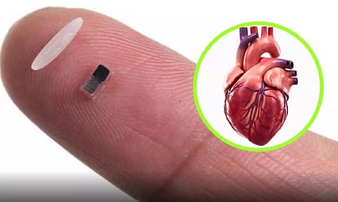 உலகின் மிகச்சிறிய `பேஸ்மேக்கர்'