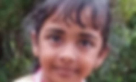 நாய் கடித்ததால் ரேபிஸ் நோய் பாதிப்பு ஏற்பட்டு சிறுமி உயிரிழப்பு