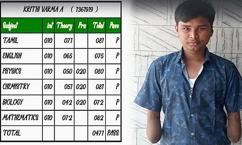 பிளஸ் 2 தேர்வில் இரு கைகளையும் இழந்த மாற்றுத்திறனாளி மாணவர் 471 மதிப்பெண்கள் பெற்று அசத்தல்