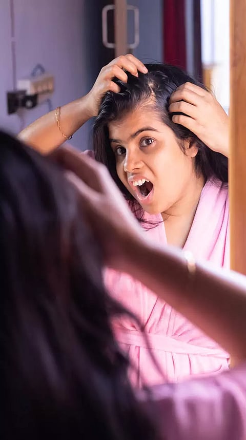 இளம் வயதிலேயே பெண்களுக்கு முடி உதிர காரணம் என்ன?