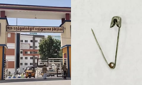 திண்டுக்கல்லில் சிறுமியின் குடலில் சிக்கிய 'சேப்டி பின்' அகற்றம்