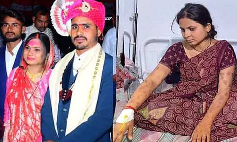 வரதட்சணை கொண்டு வராத மனைவியை கட்டிவைத்து கொதிக்கும் கத்தியால் வாயில் சூடு போட்ட கொடூர கணவன்