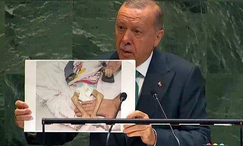 மயக்க மருந்தின்றி உறுப்புகளை இழக்கும் பிஞ்சுகள்.. 1 மணி நேரத்திற்கு 1 குழந்தையை கொல்லும் இஸ்ரேல் - எர்டோகன்