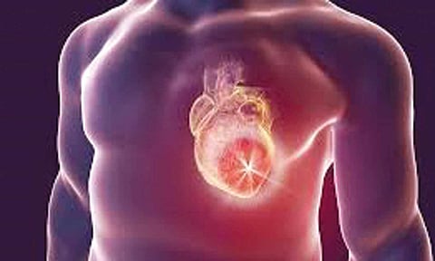 ஆஞ்சியோ சிகிச்சை என்றால் என்ன?