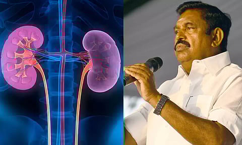 கிட்னி முறைகேடு வழக்கில் இதுவரை விசாரணை தொடங்காதது ஏன்?- இ.பி.எஸ் கேள்வி