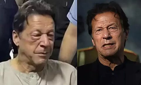 இம்ரான்கானுக்கு உயர் சிகிச்சை அளிக்க வேண்டும்- பாகிஸ்தான் அரசுக்கு 14 முன்னாள் கேப்டன்கள் கடிதம்