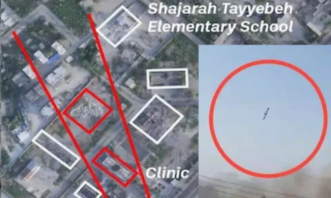 Iran School: 175 சிறுமிகள் உயிரிழப்புக்கு அமெரிக்க ராணுவமே காரணம் - வெளியான வீடியோ, சாட்டிலைட் ஆதாரம்