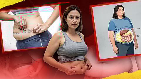 രാജ്യത്ത് സ്ത്രീകളിൽ കുടവയർ വർദ്ധിക്കുന്നു; ഫാറ്റി ലിവർ മുതല് സ്നാർബുദം വരെ ഉണ്ടായേക്കും, ജാഗ്രതാ നിർദേശവുമായി പുതിയ പഠനം