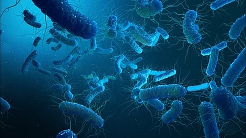 Image for representation only