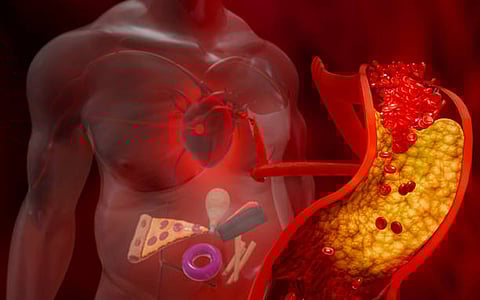 Chronic and low-grade inflammation can be a major reason that can trigger type 2 diabetes, heart disease, and non-alcoholic fatty liver.