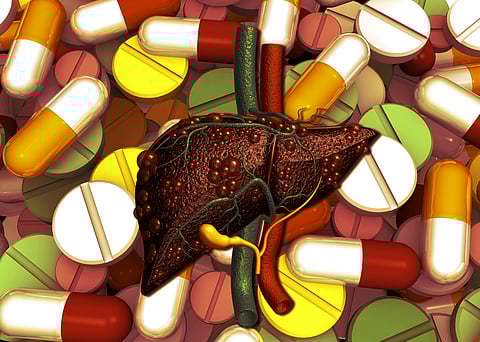 You should monitor all your food intake to keep your liver healthy.