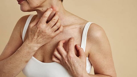 All acne vulgaris, psoriasis, and chronic urticaria studies stated the association of gut microbiome with skin manifestations.