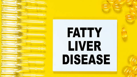 Fatty liver can be categorised into non-alcoholic fatty live disease (NAFLD/MASLD) and alcoholic fatty liver diseases (AFLD).