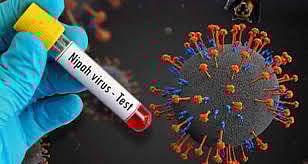 കേരളത്തിൽ വീണ്ടും നിപ മരണം