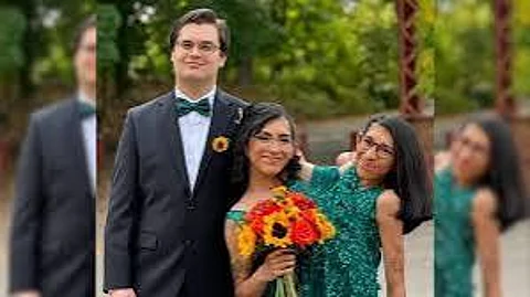 സയാമീസ് ഇരട്ടകളിൽ ഒരാൾ വിവാഹിതയായി