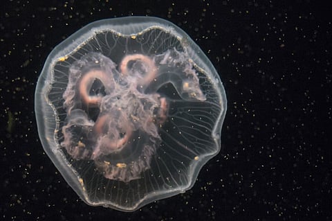 Amoebic meningoencephalitis