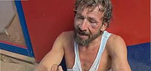 ഗ്രീസുകാരനെന്ന് വർക്കലയിൽ മർദനമേറ്റ വിദേശപൗരൻ