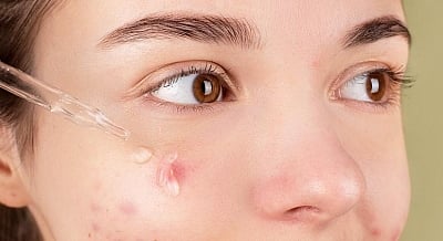 Sebum in the pores could then give way to acne into blackheads and whiteheads. While you cannot get rid of the pores, it is important to cleanse the pores which in turn helps minimize their appearance.(IANS)