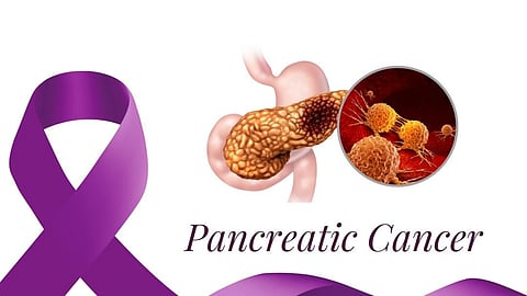 vaccine trial by US scientists has started for prevention of Pancreatic cancer