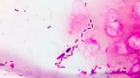 Scientists have shown how fast-growing bacteria can resist antibiotics.(Wikimedia)