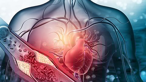 Only 7% population of adults have good cardiometabolic health (representational image - Unsplash)