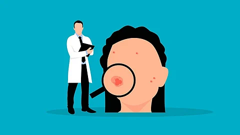 Assessing the thickness of the melanoma is difficult, whether done by an experienced dermatologist or a well-trained machine-learning algorithm (Representational image - Pixabay)