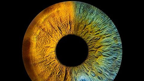 Study finds: loss of 'youth' protein leads to ageing in the eye (representational image - Unsplash)