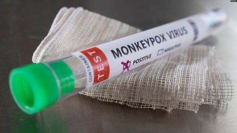 US Officials Announce More Steps Against Monkeypox Outbreak (representational image - VOA)