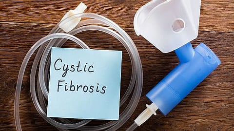 Delays in Initial Cystic Fibrosis Evaluation in Infants of Color (representational image - Unsplash)