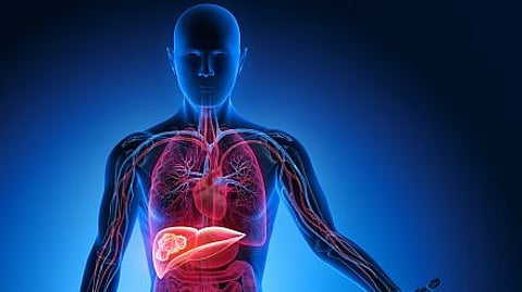 Study reveals: p53 in liver cancer, is this an ultimate betrayal ? (representational image - Unsplash)