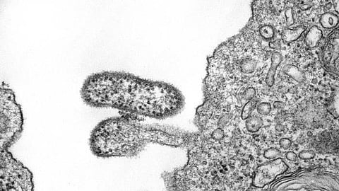 Study finds: Giant Viruses Build a Cell Nucleus Like Our Own (representational image - CDC PHIL)