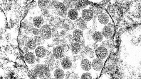 Quicker palliative care referrals for severely ill COVID patients (CDC PHIL)