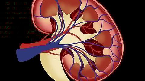 A recent study in CJASN indicates that many patients on the transplant waitlist would prefer accepting such lower quality kidneys in return for a shorter waiting time (Pixabay)