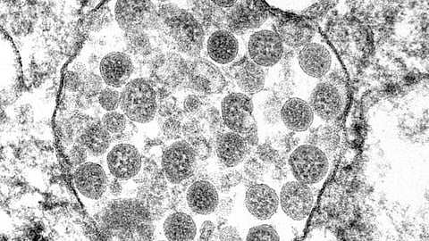 Previous Omicron infections provide defense against new variants (CDC PHIL)