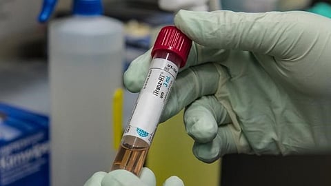 Largest domestic mobilization: New York Guard COVID response  (representational image - CDC PHIL)