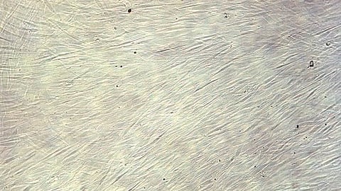 Study: Stem cells could aid repair of spinal cord damage (CDC PHIL)