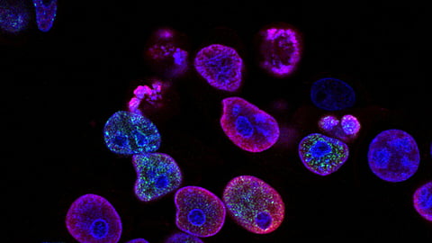 Explained: Why men face a higher risk of most types of cancer ? (representational image - Unsplash)