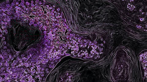 Study finds: Hyaluronic acid helps repair damaged muscles (representational image - Unsplash)