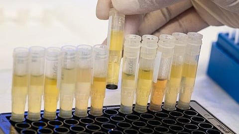 COVID antibody research conducted at VUMC lands national award (representational image - CDC PHIL)